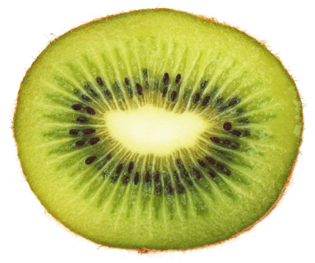 Kiwifruit